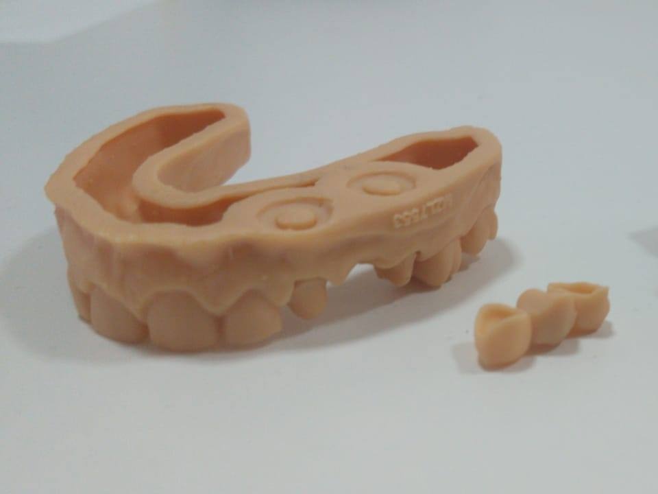 3D Printing Limburg | https://www.3dprintinglimburg.nl/files/afbeeldingen/portfolio/Dental2 Cropped.jpg